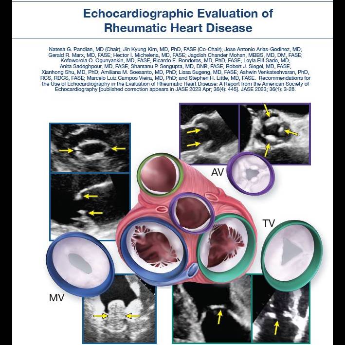 Echocardiographic Evaluation of RHD Insert