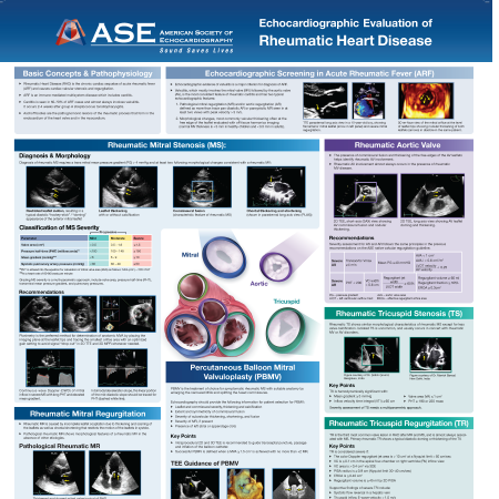 Echocardiographic Evaluation of RHD  FLIP Chart Poster
