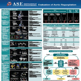 Aortic Regurgitation Flip Chart Poster