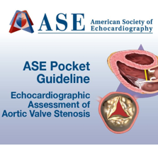Aortic Valve Stenosis Pocket Guide