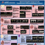  Spectral Doppler Images for the TTE Protocol Flip Chart Poster