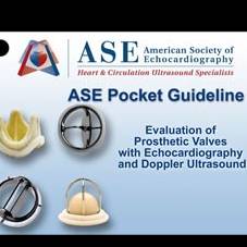 Prosthetic Valves With Echo and Doppler Ultrasound Pocket Guide - Update coming