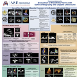 Prosthetic Valves With Echo and Doppler Ultrasound Poster- Update coming