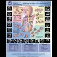 Performance of a Pediatric Echocardiogram Poster