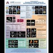 Prosthetic Valves with Echo and Doppler Ultrasound Flip Chart Poster- Update coming