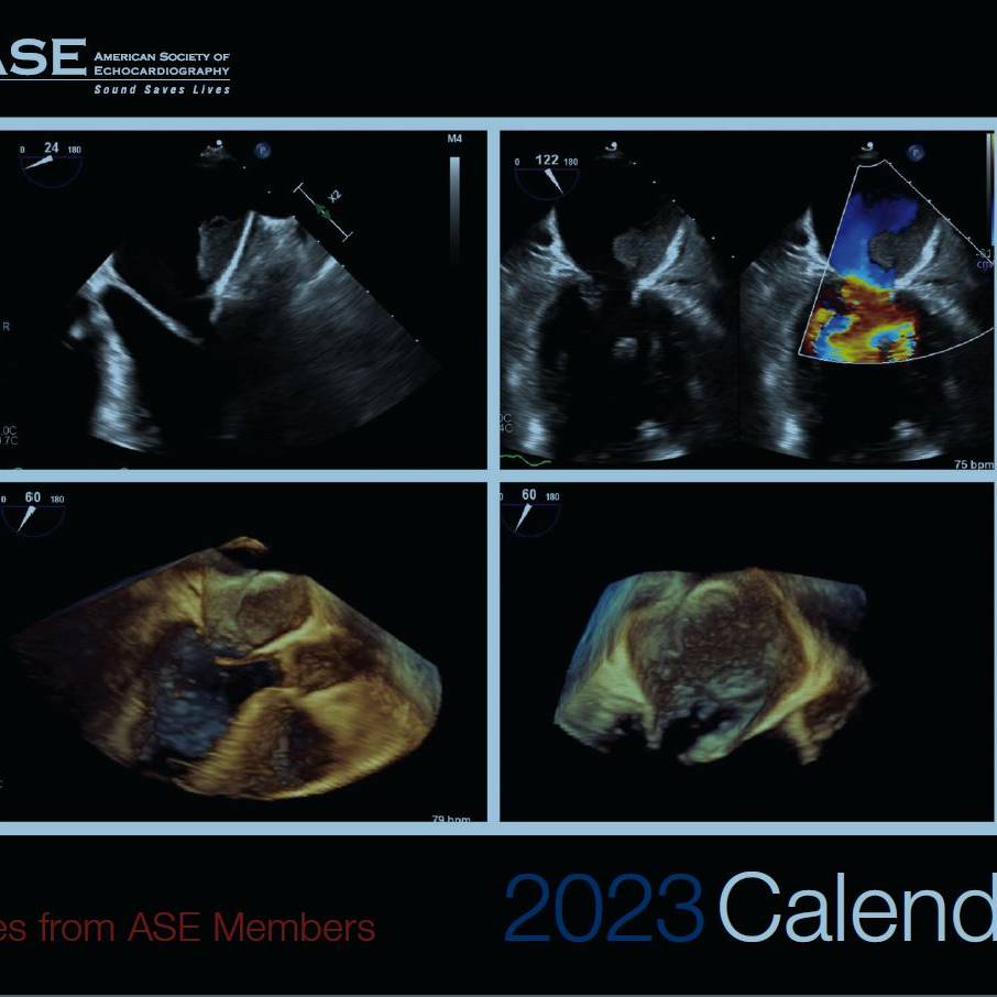 ASE Image Calendar 2023