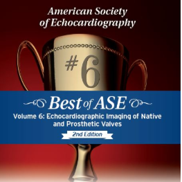 Best of ASE Volume 6: Echocardiographic Imaging of Native and Prosthetic Valves, 2nd Edition